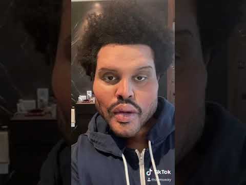 The Weeknd’s Plastic Surgery Before and After! (MUST WATCH) | tiktok edition 😭‼️ read description